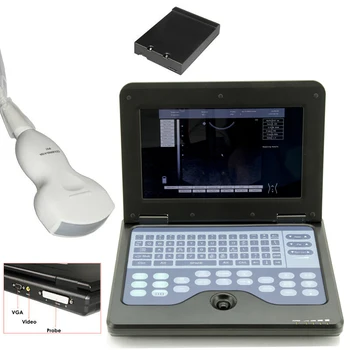  Портативный ультразвуковой сканер CMS600P2 B, портативный диагностический аппарат для брюшной полости с зондом, высокая эффективная способность обработки данных
